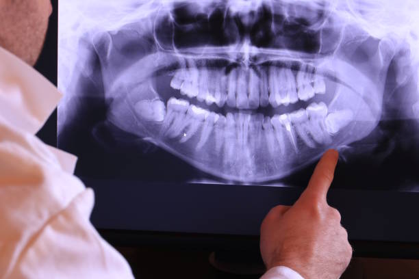 Best Emergency Wisdom Teeth Removal in Raubsville, PA